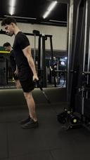 Bíceps bayesiana unilateral